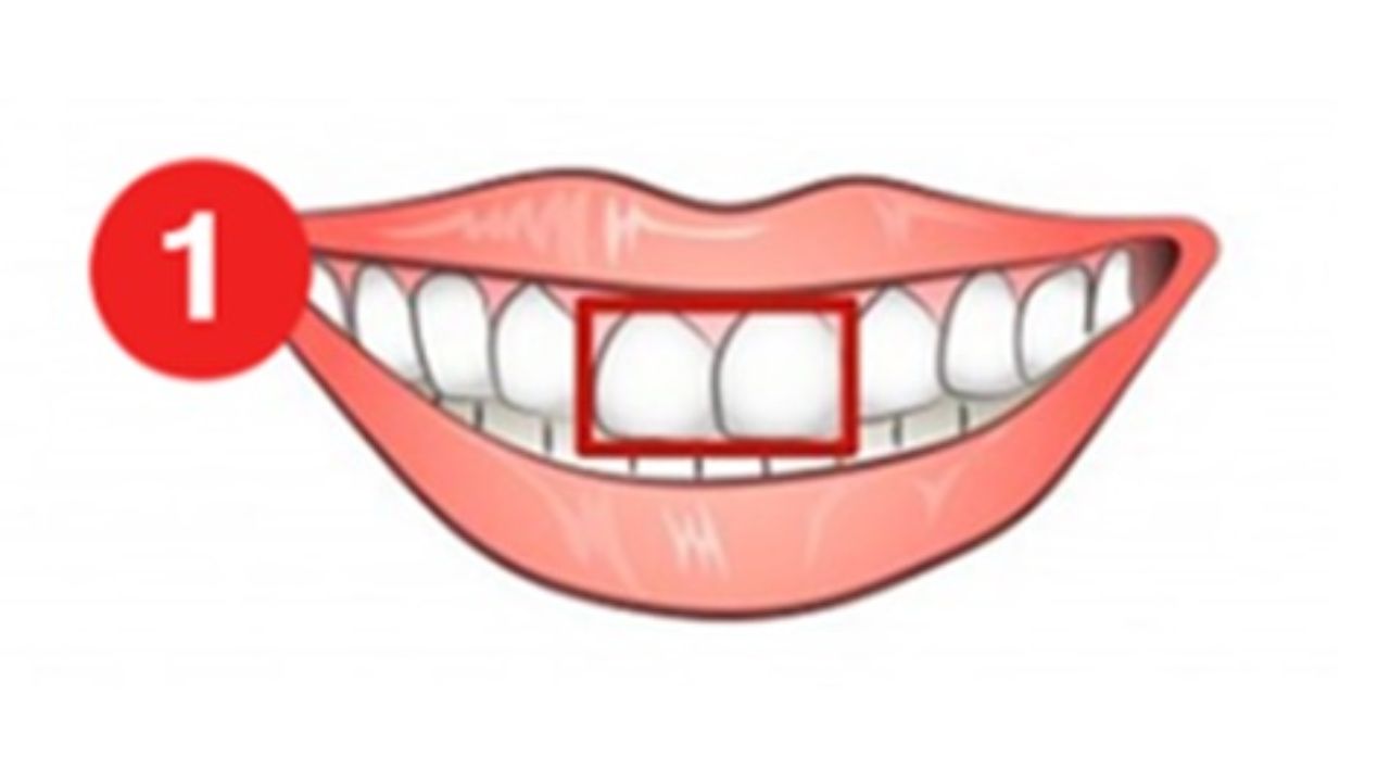 formato dos dentes
