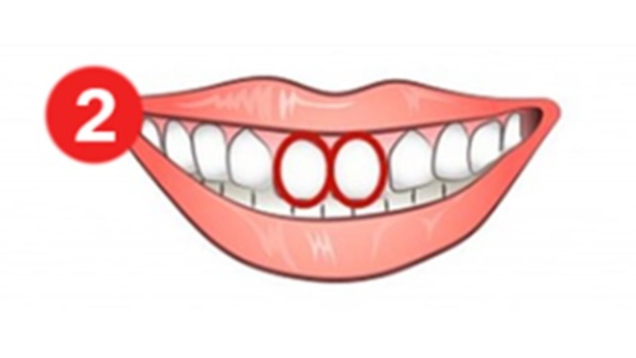 formato dos dentes