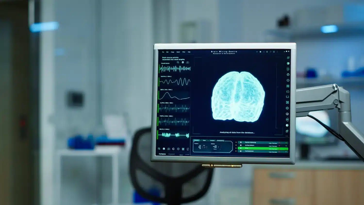 Análise cerebral: neurocirurgia e suas complexidades Tela de computador exibindo uma análise cerebral, representando a neurocirurgia e os estudos sobre o sistema nervoso.