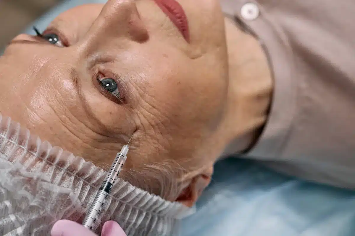 Procedimento de aplicação de botox em paciente Aplicação de botox em paciente idosa durante procedimento estético.