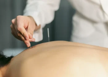 Sessão de acupuntura aplicada por profissional em ambiente clínico.