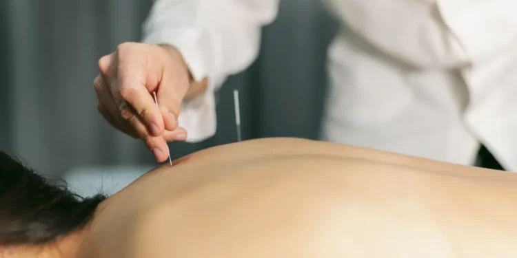 Sessão de acupuntura aplicada por profissional em ambiente clínico.