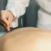 Sessão de acupuntura aplicada por profissional em ambiente clínico.