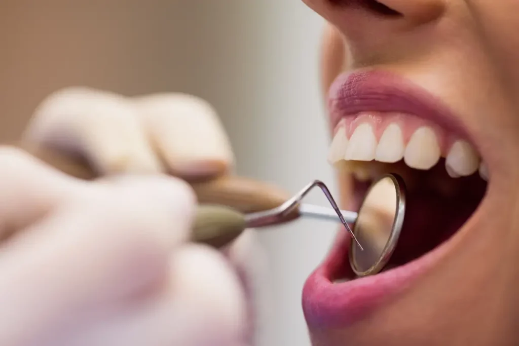 Exame da boca de uma paciente com espelho odontológico e sonda, realizado por profissional com luvas.