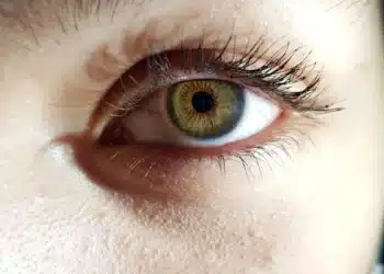 Olho humano com íris verde e detalhes sob luz intensa.