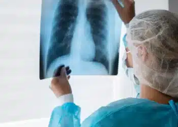 Profissional de saúde analisa radiografia de tórax em ambiente hospitalar.