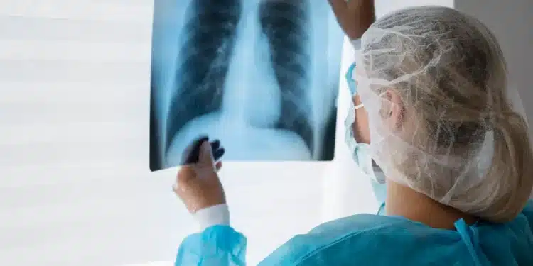 Profissional de saúde analisa radiografia de tórax em ambiente hospitalar.