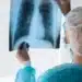 Profissional de saúde analisa radiografia de tórax em ambiente hospitalar.